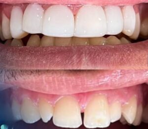 نمونه کار دکتر امیر پرواز