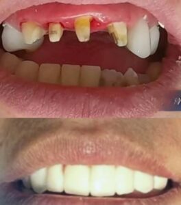 نمونه کار دکتر امیر پرواز