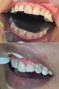 نمونه کار دکتر آرام احمدی