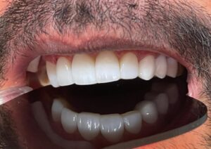 نمونه کار دکتر آرام احمدی