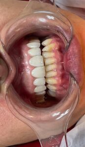 نمونه کار دکتر آرام احمدی