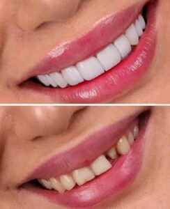 نمونه کار دکتر فاطمه جلیلیان