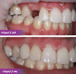نمونه کار دکتر فاطمه جلیلیان