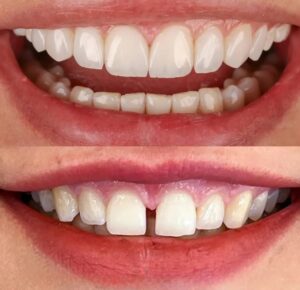 نمونه کار دکتر فاطمه جلیلیان