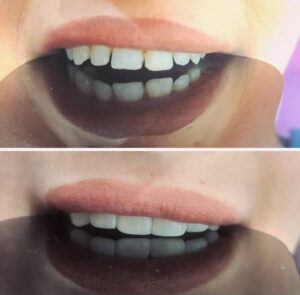 نمونه کار دکتر فاطمه نیازی