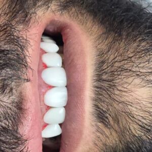 نمونه کار دکتر فاطمه نیازی