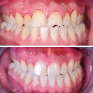 نمونه کار دکتر حسین داوری نژاد