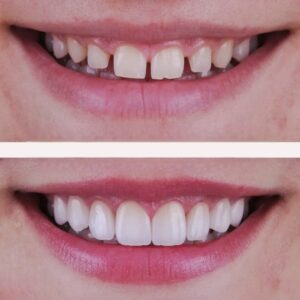 نمونه کار دکتر حسین داوری نژاد