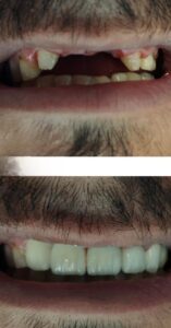 نمونه کار دکتر محمدرضا فرهنگیان