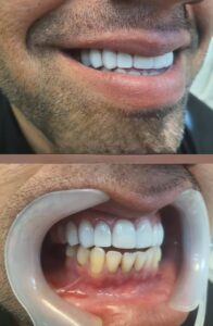 نمونه کار دکتر محمدرضا فرهنگیان