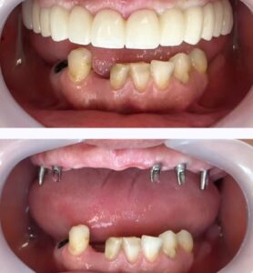 نمونه کار دکتر محمدرضا فرهنگیان