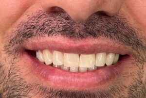 نمونه کار دکتر دیانا مرادیان