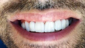 نمونه کار دکتر علی حسینی