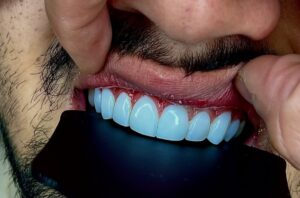 نمونه کار دکتر امیرحسین دوگوهر