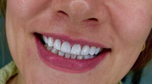 نمونه کار دکتر امیرحسین دوگوهر