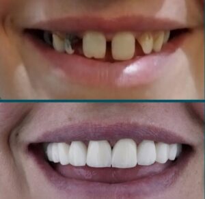 نمونه کار دکتر امیرحسین کرمی