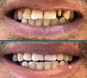 نمونه کار دکتر امیرحسین کرمی