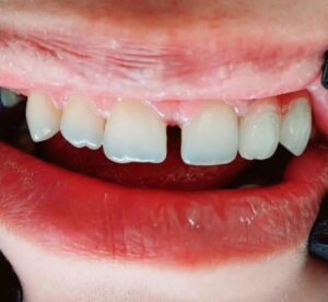 نمونه کار دکتر بهاره منصوری