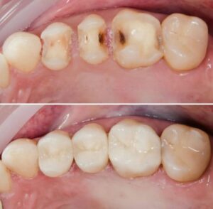 نمونه کار دکتر بهاره منصوری