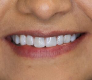 نمونه کار دكتر مهتا ويسى