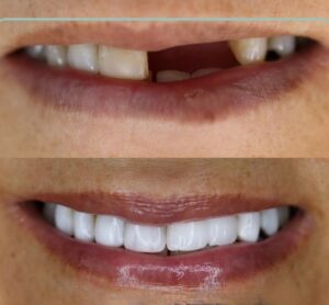 نمونه کار دكتر مهتا ويسى