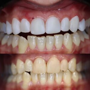 نمونه کار دكتر مهتا ويسى