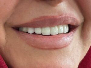 نمونه کار دکتر روزبه تیزوال