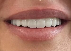 نمونه کار دکتر روزبه تیزوال