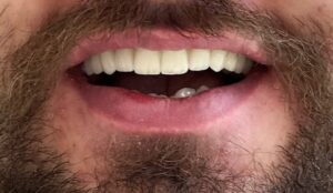 نمونه کار دکتر روزبه تیزوال