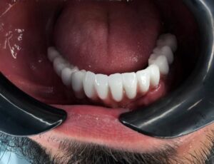 نمونه کار دکتر روزبه تیزوال