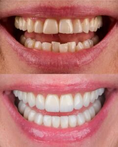 نمونه کار دکتر قشقایی