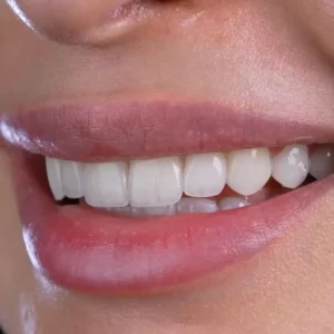 نمونه کار دکتر قشقایی