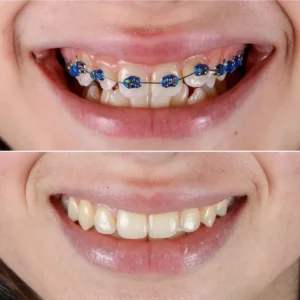 ارتودنسی دکتر قشقایی