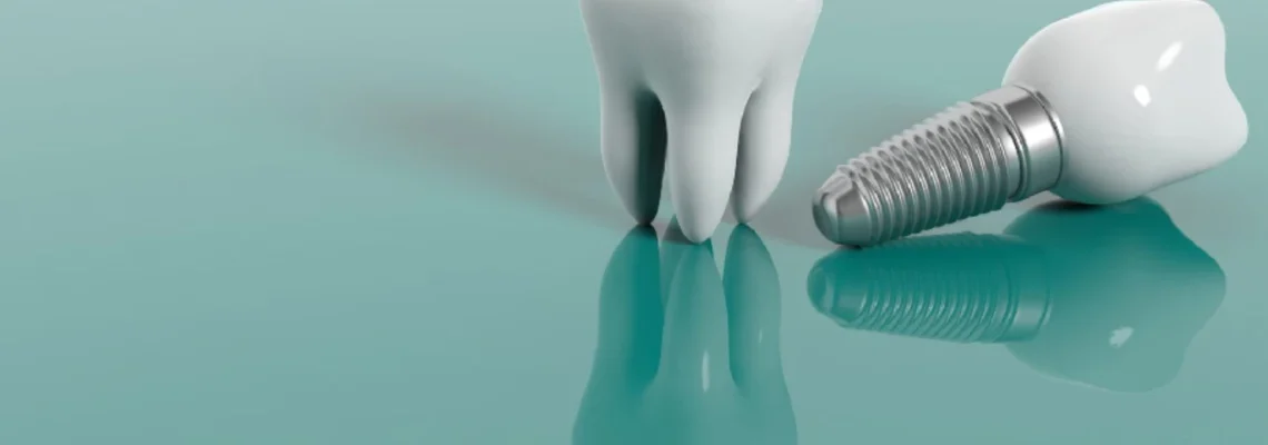 ایمپلنت دندان ارزان در کرمانشاه