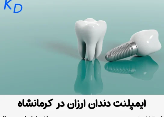 ایمپلنت دندان ارزان در کرمانشاه