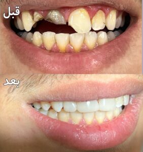 نمونه کار دکتر امیر رجایی