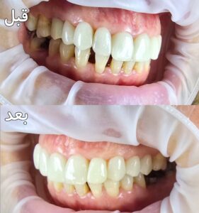 نمونه کار دکتر امیر رجایی