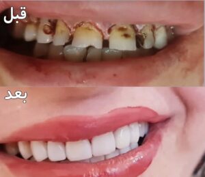 نمونه کار دکتر گلاره همتی