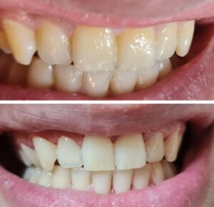 نمونه کار دکتر گلاره همتی