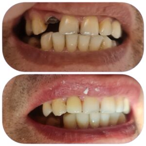 نمونه کار دکتر گلاره همتی