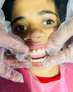 نمونه کار دکتر ثریا وکیلی