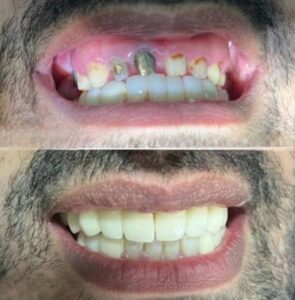 نمونه کار دکتر ثریا وکیلی