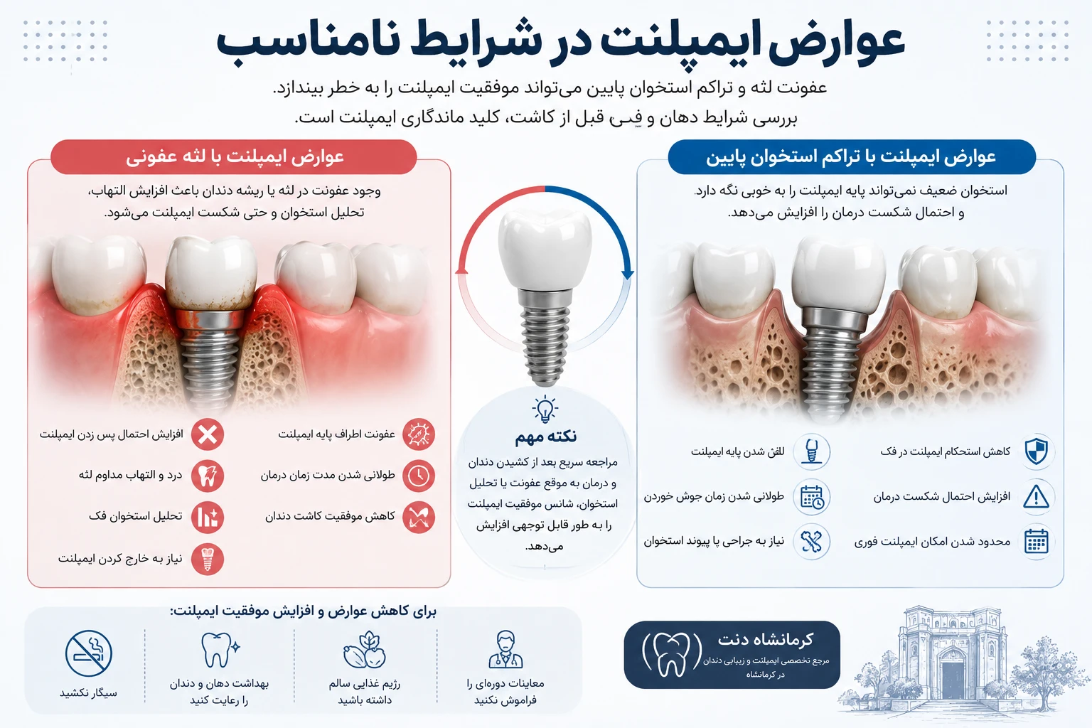 عوارض ایمپلنت کردن با عفونت
