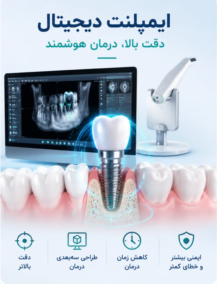 ایمپلنت دیجیتال