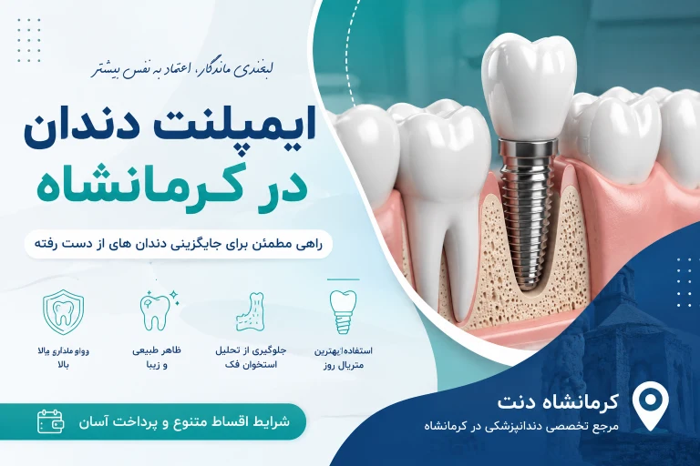 ایمپلنت دندان در کرمانشاه