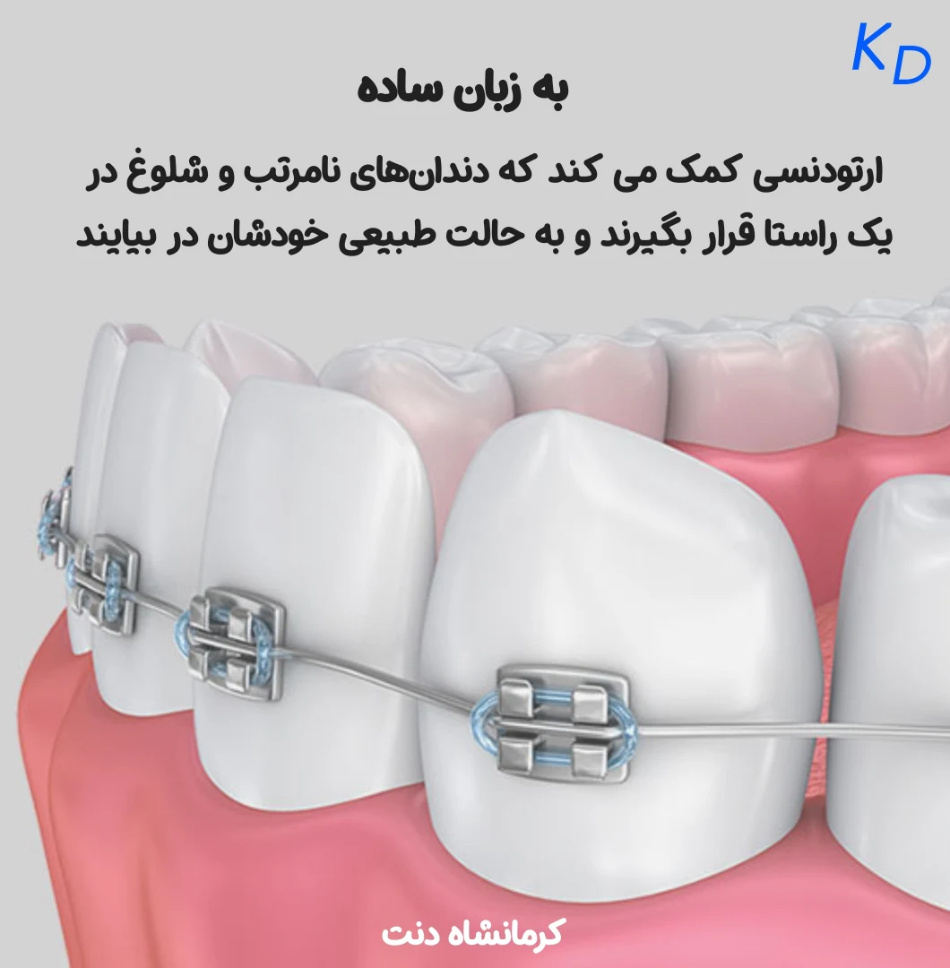تعریف ارتودنسی به زبان ساده