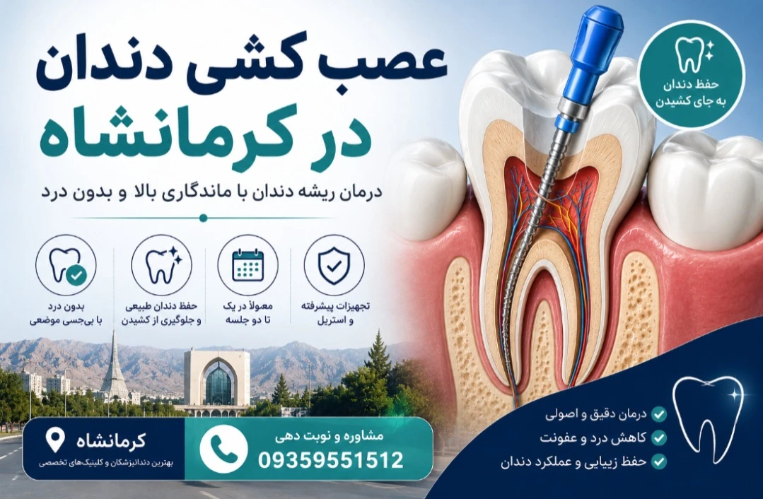 هزینه و بهترین دکتر عصب کشی دندان در کرمانشاه