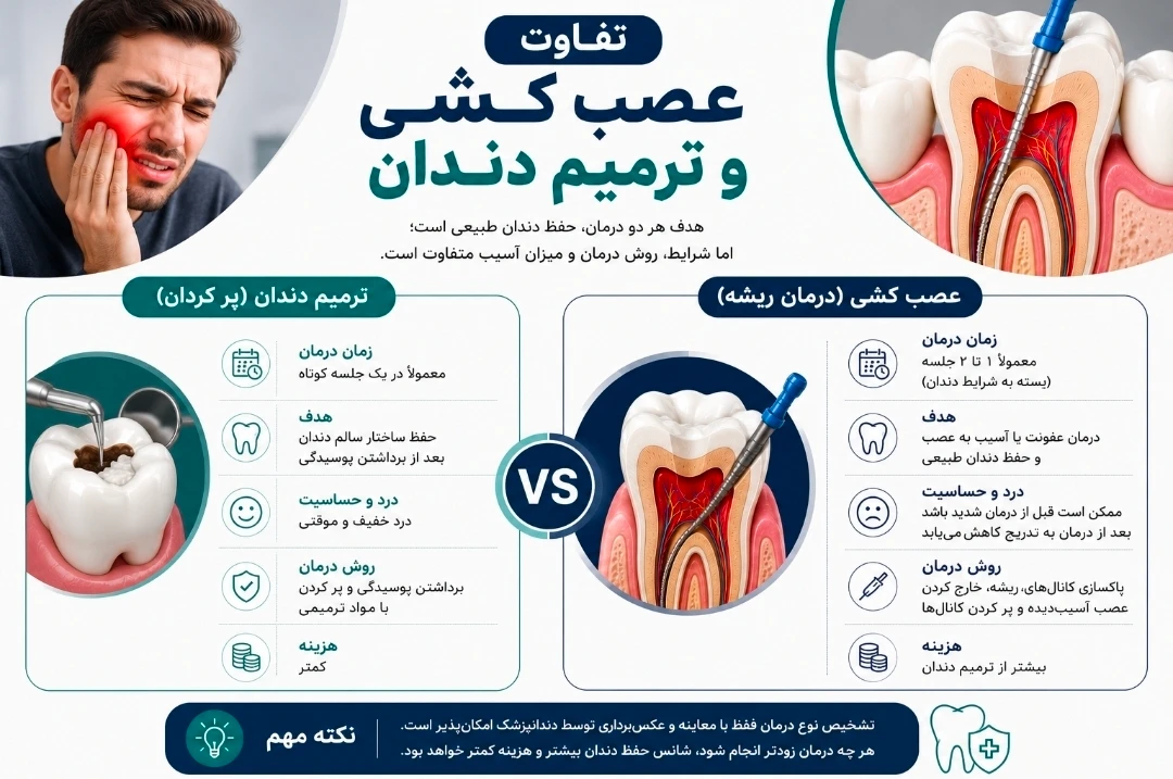 تفاوت عصب کشی و پر کردن دندان